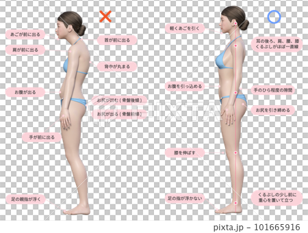水色の水着を着た猫背の3dモデルの女性と正しい姿勢の女性のセット 101665916