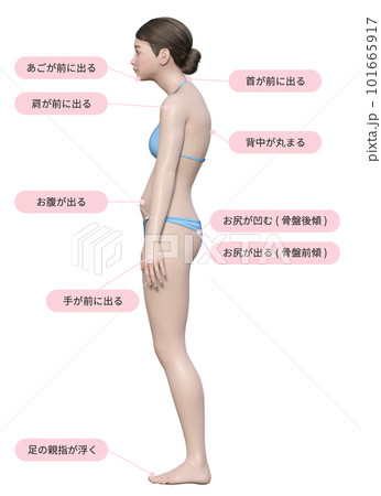 水色のビキニを着けた猫背の3dモデルの女性と解説のイラスト 101665917