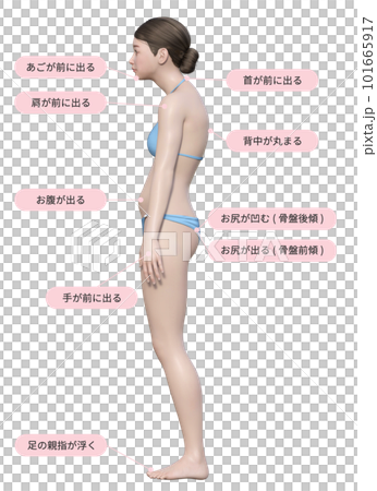 水色のビキニを着けた猫背の3dモデルの女性と解説のイラスト 101665917
