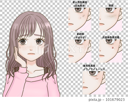 Woman suffering from dark spots and freckles, long hair 101679023