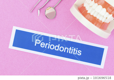 The Teeth model with Periodontitis dental disease on pink color background. 101696518