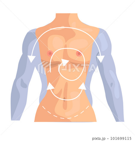 Sex-change operation illustration in color cartoon style. Editable vector graphic design. Sex-change operation illustration in color cartoon style. Editable vector graphic design. 101699115