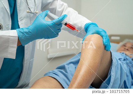Asian elderly woman patient show her scars surgical total knee joint replacement Suture wound surgery arthroplasty in hospital, healthy strong medical concept. Asian elderly woman patient show her scars surgical total knee joint replacement Suture wound surgery arthroplasty in hospital, healthy strong medical concept. 101715705