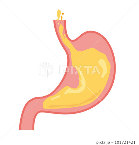 逆流性食道炎のイメージイラスト 101721421