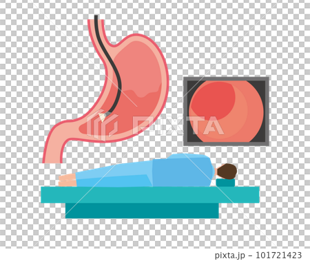 Image illustration of examination with gastroscope 101721423