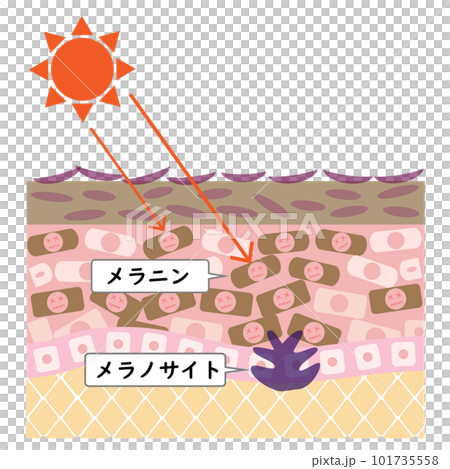 Cross section of rough skin. Image of stains caused by ultraviolet rays. Cross section of rough skin. Image of stains caused by ultraviolet rays. 101735558