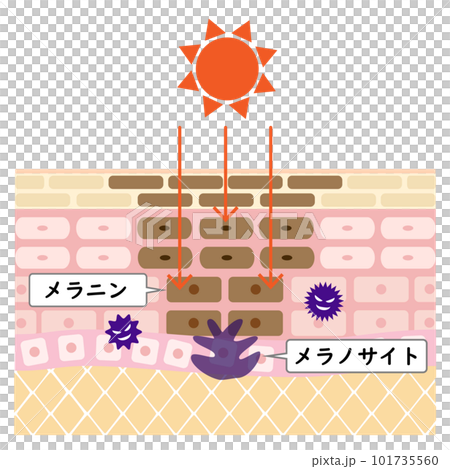 Cross section of rough skin. Image of stains caused by ultraviolet rays. Cross section of rough skin. Image of stains caused by ultraviolet rays. 101735560