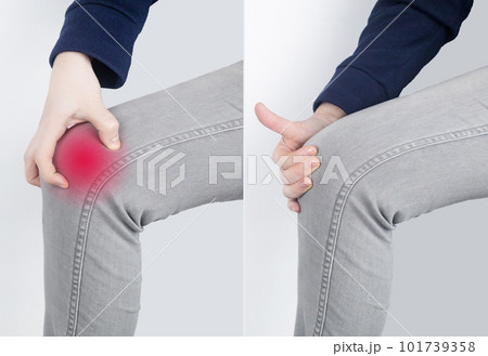 Before and after. Woman has severe knee pain. Ruptured knee tendons, muscles, meniscus injury, fracture or fracture of bones. Providing medical care for injuries to joints or cartilage tissue 101739358