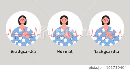 Types of heart arrhytmia. Bradycardia, tachycardia and horalhertbeat rhythm. Woman press her chest with hand. Flat vector isolated illustration Types of heart arrhytmia. Bradycardia, tachycardia and horalhertbeat rhythm. Woman press her chest with hand. Flat vector isolated illustration 101750404
