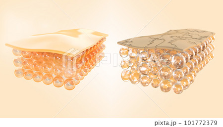 Structure of healthy and damaged skin, normal and dry 3d render set. Treatment, repair and renewal of facial skin of cosmetic cream, cleaning, peeling or laser. Skin layers with cells. 3D illustration 101772379