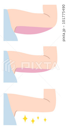 女性の二の腕のイラスト素材 101775490