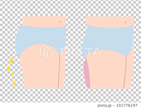 腿緊粗腿圖集 腿緊粗腿圖集 101776297