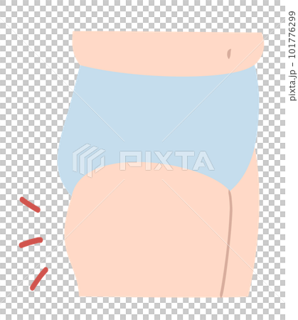 女人腿粗大粗隆的插圖素材 女人腿粗大粗隆的插圖素材 101776299