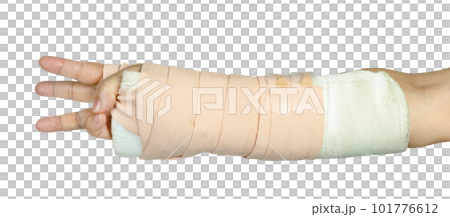 Hand making physical therapy to broken wrist from accident isolated 101776612