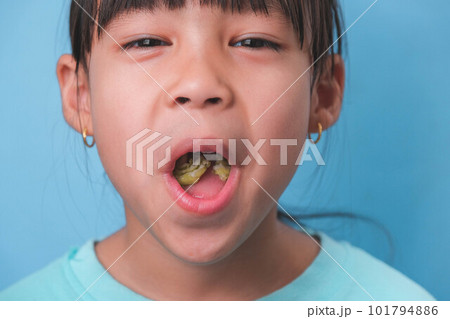 Smiling cute little girl eating sweet gelatin with sugar added isolated on blue background. Children eat sugary sweets, causing loss teeth or tooth decay and unhealthy oral care. 101794886