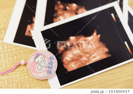 エコー写真　マタニティマーク 101800437