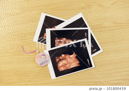 エコー写真　マタニティマーク 101800439