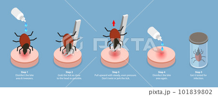 3D Isometric Flat Vector Conceptual Illustration of How To Remove a Tick 101839802