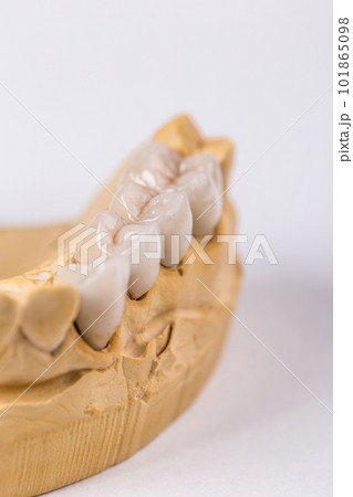 Artificial teeth Artificial teeth 101865098