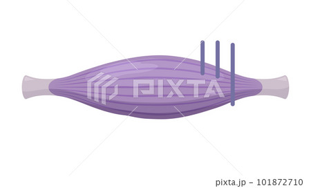 不健康な筋肉のイラスト 101872710