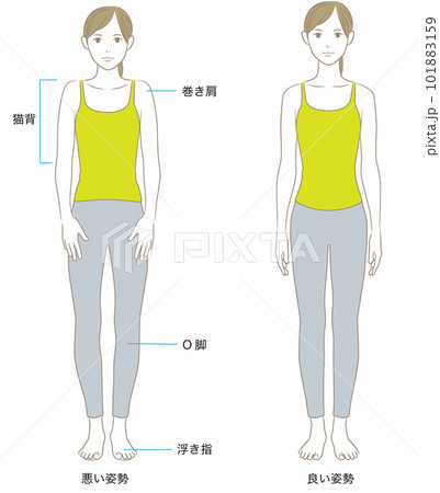 正面から見た良い姿勢と悪い姿勢の女性 正面から見た良い姿勢と悪い姿勢の女性 101883159