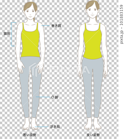 正面看姿勢好壞的女人 正面看姿勢好壞的女人 101883159