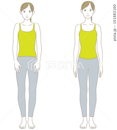 正面から見た良い姿勢と悪い姿勢の女性 正面から見た良い姿勢と悪い姿勢の女性 101883160