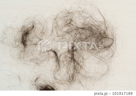 unhealthy hair loss on floor 101917189