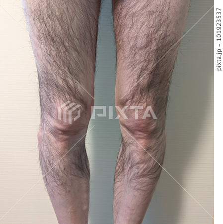 男性のモジャモジャすね毛 101923537