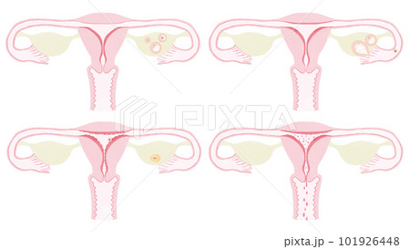月経中の子宮頸部の特徴