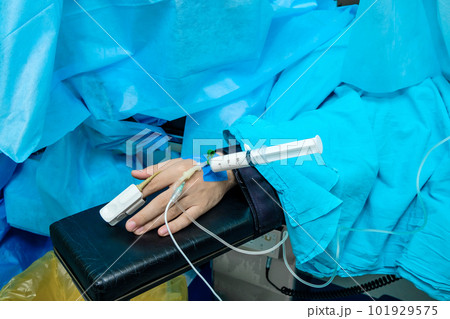 A syringe with anesthetic medicine is installed in a catheter A syringe with anesthetic medicine is installed in a catheter 101929575