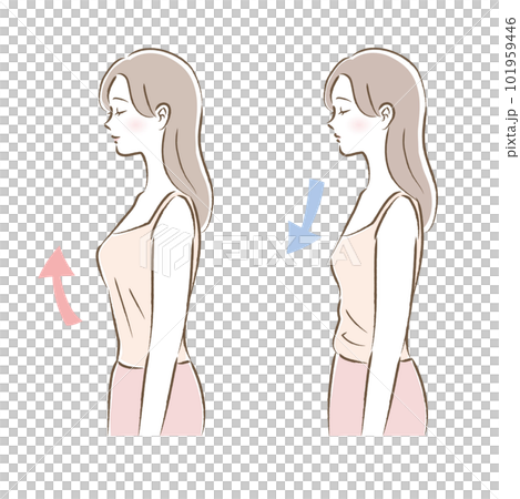 Before-after illustration of a woman wearing a camisole bra top with cups 101959446