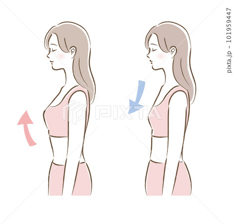 バストアップブラ・ナイトブラを着用した女性のビフォーアフターのイラスト 101959447