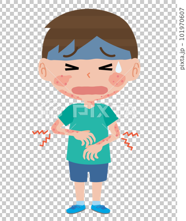 boy with atopic dermatitis 101970607