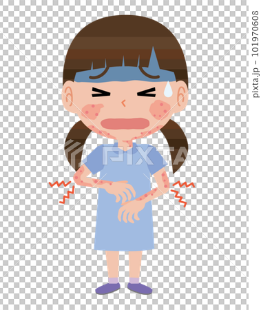 アトピー性皮膚炎の女の子 101970608