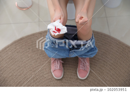 Woman holding toilet paper with blood stain in rest room, closeup. Hemorrhoid concept Woman holding toilet paper with blood stain in rest room, closeup. Hemorrhoid concept 102053951