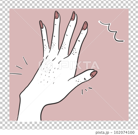 患有多餘腋毛的年輕女性 102074100