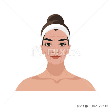 Portrait of a mature woman with wrinkles and age changes, cosmetic procedures, injections, plastic surgery, vector cartoon illustration isolated on a white background. Portrait of a mature woman with wrinkles and age changes, cosmetic procedures, injections, plastic surgery, vector cartoon illustration isolated on a white background. 102120416