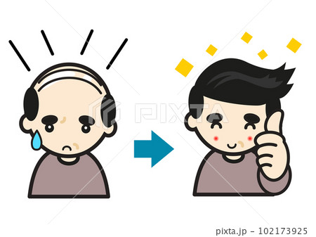 髪が増えて喜ぶ男性 髪が増えて喜ぶ男性 102173925