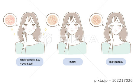 肌のキメが乾燥/潤う若い女性のイラストセット 肌のキメが乾燥/潤う若い女性のイラストセット 102217026