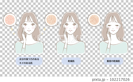 肌のキメが乾燥/潤う若い女性のイラストセット 肌のキメが乾燥/潤う若い女性のイラストセット 102217026
