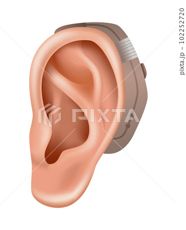Hearing aid. Sound amplifier for patients with hearing loss. Medicine and health. Realistic object behind the ear. Treatment and prosthetics in otolaryngology 102252720