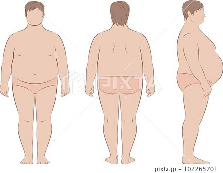 Fat man figure. Front, back, side. 102265701