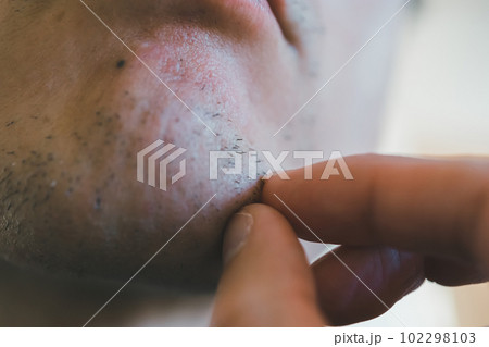 あごヒゲを指で抜く男性 102298103