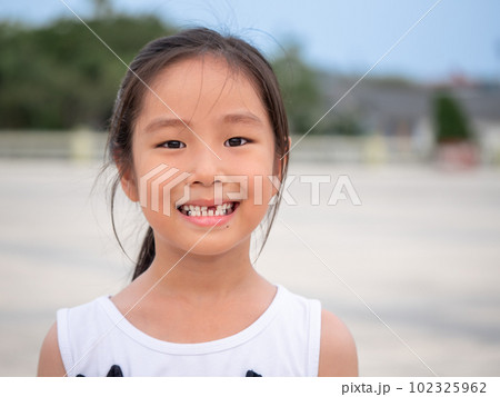 close up shot of face asian child cute or kid girl smiling eyes white teeth and one broken tooth or drop from baby or milk tooth on 7 years old close up shot of face asian child cute or kid girl smiling eyes white teeth and one broken tooth or drop from baby or milk tooth on 7 years old 102325962