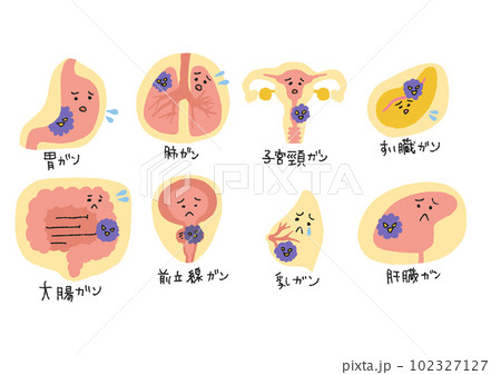 がんになった臓器の親しみやすいイラスト 102327127