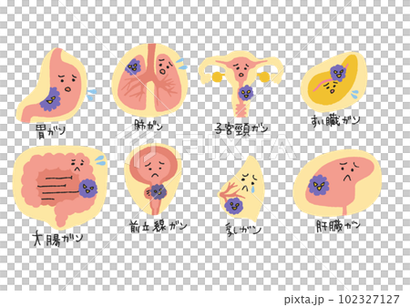 がんになった臓器の親しみやすいイラスト 102327127