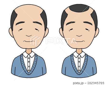 はげた中年男性のイラスト（カッパはげとザビエルはげ） 102345705