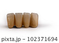 The Perfect Smile: Enhancing Dental Aesthetics with Brown Crowns 102371694