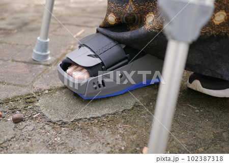 women broken feet with a grey plastic boot ankle brace injury protecting boot women broken feet with a grey plastic boot ankle brace injury protecting boot 102387318